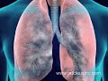 2008 Nucleus 3D Medical Animation Demo Reel