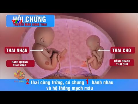 Can thiệp điều trị cho bé từ trong bụng mẹ