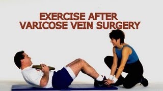 Exercise After Varicose Vein Surgery  What is the Best Exercise