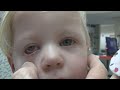 Kawasaki Disease
