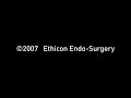 Gastric Bypass animation