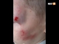 Полицейские разыскивают водителя, сбившего 8-летне