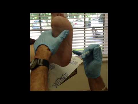 Plantar fasciitis steroid injection on youtube