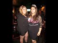 Gastric Bypass surgey before and after 1 year