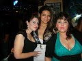 Gastric Bypass surgey before and after 1 year