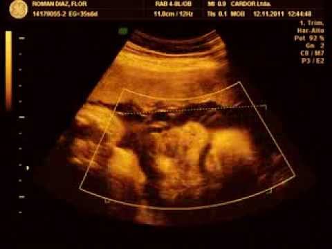 MusikaDisco.CoM » Bolocazo Video MP3 Online Gratis