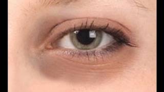 best eye cream combat wrinkles dark circles puffy eyes best eye cream 