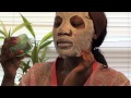 Intensive treatment for discoloration