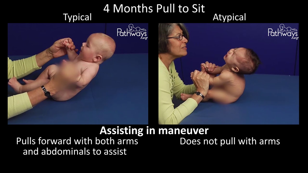 Movement: Babies 8 to 12 Months 