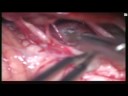 Brain Worm