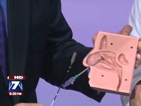 Balloon Sinuplasty Austin