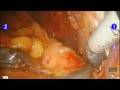 lymph nodes