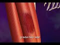 Pulling a Hamstring Muscle - What Is a Pulled Hamstring