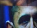 WHAT IS THIS 'THING' ON OBAMA'S HEAD?????????