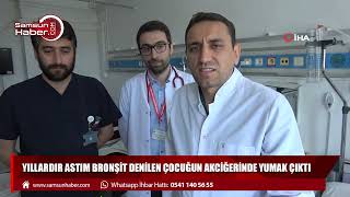 Yıllardır astım bronşit denilen çocuğun akciğerinde yumak çıktı