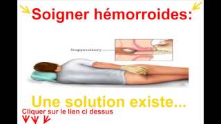 Astuces Contre Les Hémorroïdes – Creme Hemorroide Astuces Contre Les Hémorroïdes – Creme Hemorroide