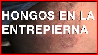 Las enfermedades de las uñas de las manos el tratamiento de la foto