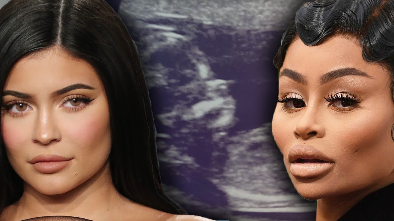 Kylie Jenner dating Travis Scott again & Blac Chyna Pregnancy Explained