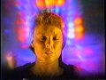 The History of Aura Imaging