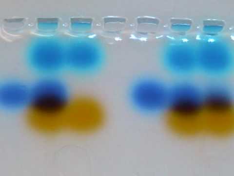 Page+gel+electrophoresis