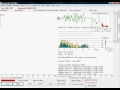 Ωτοακουστικές Εκπομπές www.ear-care.eu Otoacoustic Emissions