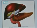 Pancreatite Pancreatite