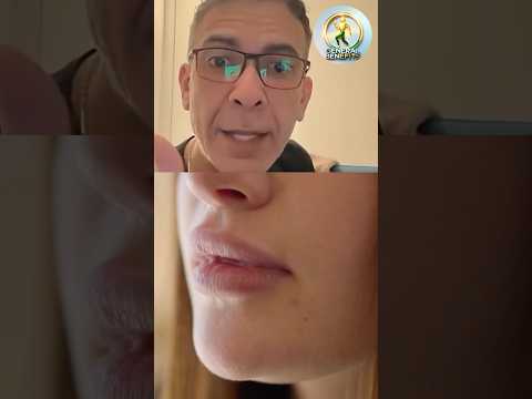 ارتجاع المريء… السبب الخفي وراء تآكل الأسنان!🚨#الصحة #معلومات_صحية #فوائد #تغذية_سليمة