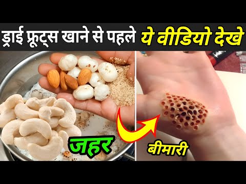 ड्राई फ्रूट्स खाने से पहले ये वीडियो देखे | Dry Fruits Side Effects | Dry Fruits Ke Nuksan