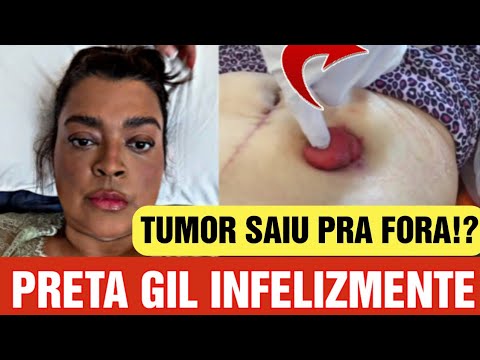 Notícias de Preta Gil diretamente do hospital infelizmente!