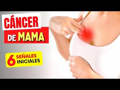 6 SEÑALES de Alerta del CÁNCER de MAMA que Todos Deberían Conocer (¡y Consejos IMPORTANTES!)