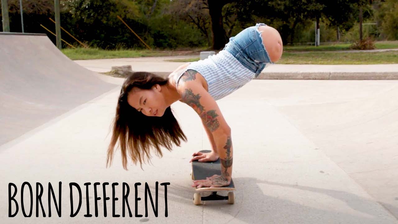 Born without legs - but i can still do anything - born different