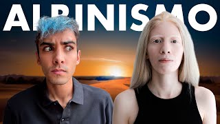 ENTREVISTÉ a una persona ALBINA