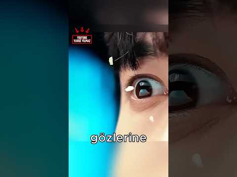 Her Şeyi GÖREBİLİYORDU😂❤️