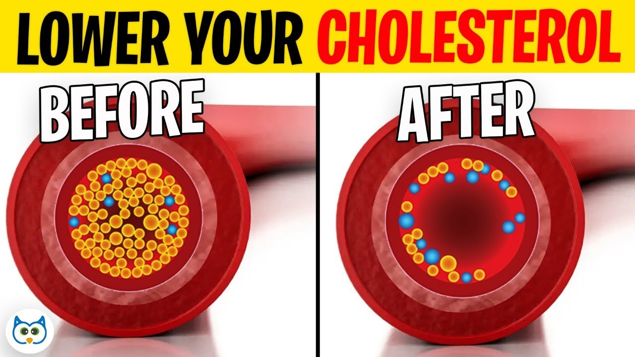 How To LOWER CHOLESTEROL Naturally (see results in just 1 WEEK)￼