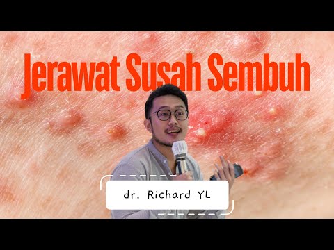 kenapa jerawat susah sembuh?