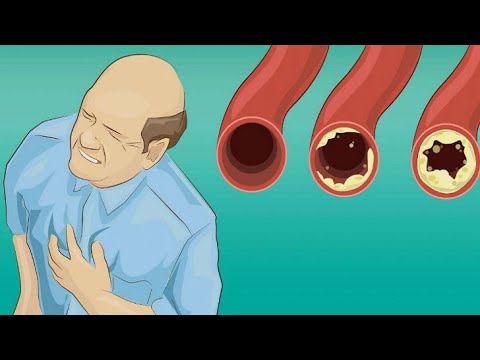 Eat These 8 Foods to Cleanse Your Arteries