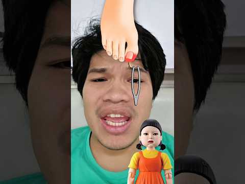 โกโกวาโดนหนามตำเท้า!! #funny #challenge #shortsfeed #fypシ゚viral