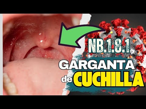¡CUIDADO! BAUTIZAN A VARIANTE COVID-19 NIMBUS COMO VARIANTE "GARGANTA DE CUCHILLA" ¿POR QUÉ?