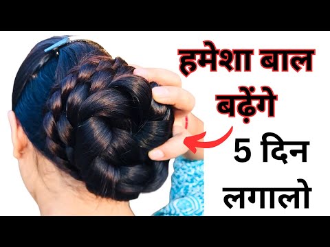 5 दिन 1₹ की ये चीज़ बालों में लगालो, बालों को जल्दी लंबा करने का तारिका, Long Hair in 30 Days, Hair