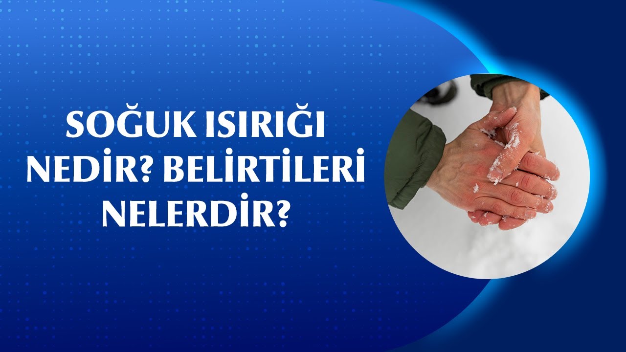 El ve Ayaklarda Soğuk Isırığı Neden Oluşur? Belirtileri Nelerdir?