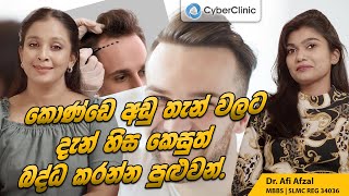 කොණ්ඩෙ අඩු තැන් වලට දැන් හිස කෙසුත් බද්ධ කරන්න පුළුවන් Cyber Clinic