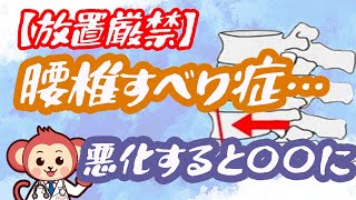 【意外と多い】その腰の痛みもしかしたら腰椎すべり症かも