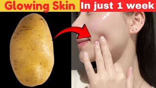 आलू का रस देगा बेदाग़ गोरी त्वचा: Skin Whitening & Pigmentation Treatment with Potato at home