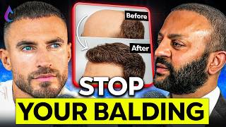 How to Stop Your Hair Loss Before It's Too Late (Full Guide) | Dr. Raghu Reddy