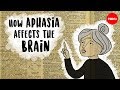Understanding Aphasia