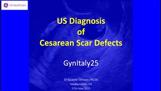 Ultrasound diagnosis of Cesarean Scar Defects at GynItaly25