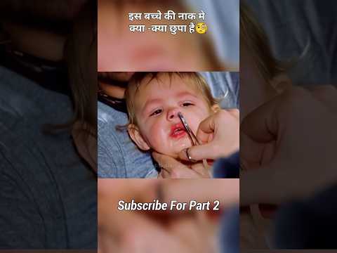 इस बच्चे की नाक मे कया-क्या है🤯 #shortsvideo