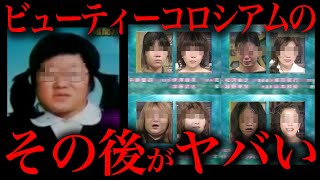 ビューティーコロシアム整形後の現在が洒落にならない