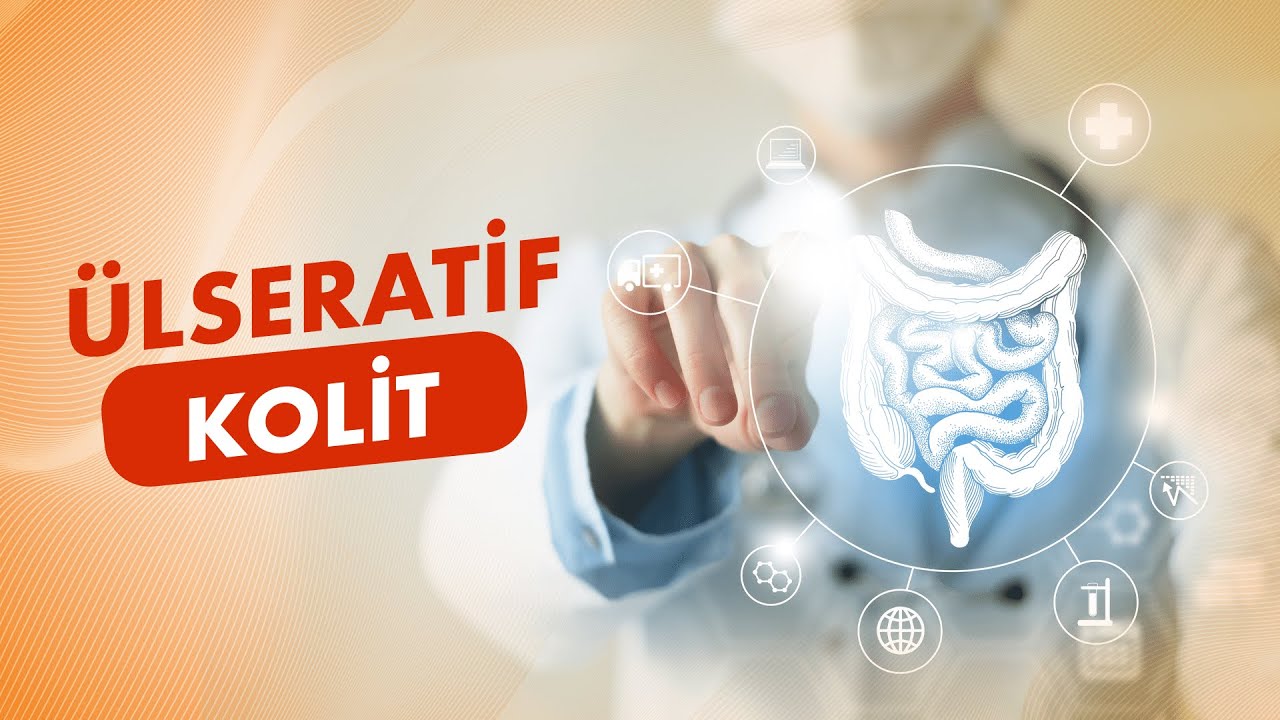 Ülseratif Kolit Nedir? Belirtileri, Tedavi Yöntemleri ve Daha Fazlası