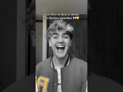 tengo los dientes amarillos😱🔥